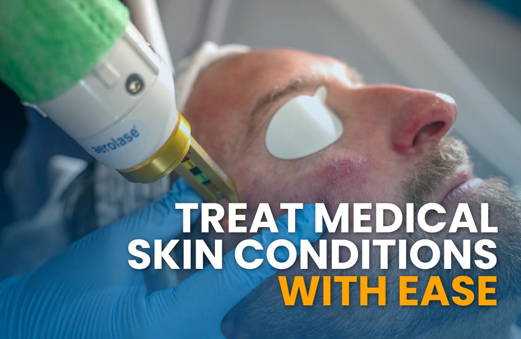 Aerolase Neo Elite Treat Medical Skin Conditions with Ease