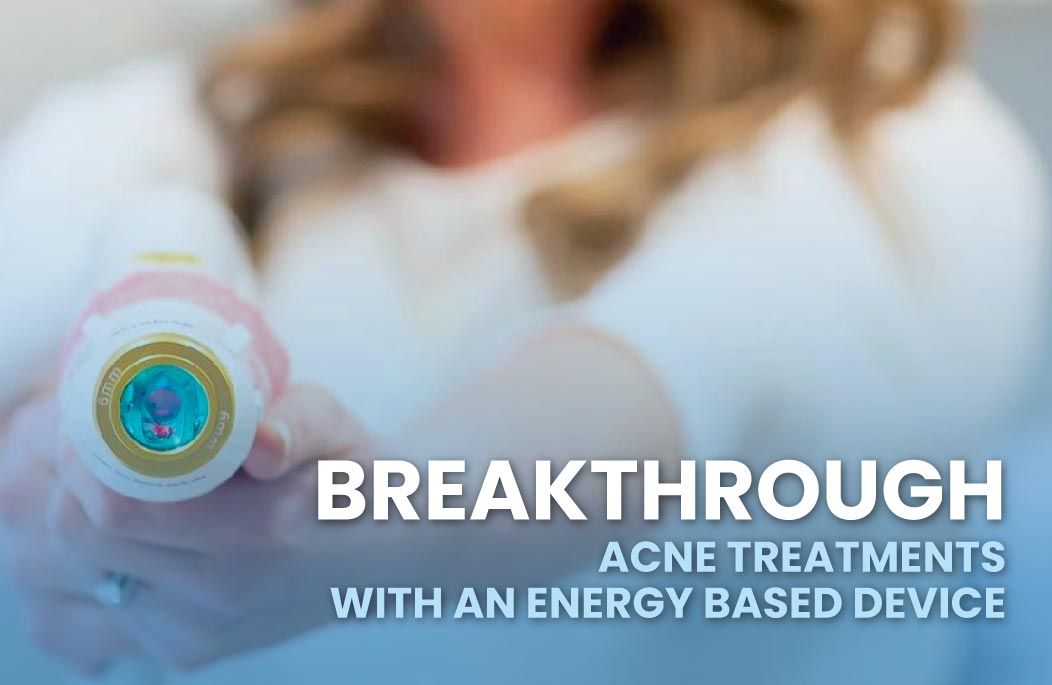 Aerolase Breakthrough Acne Treatments with an Energy-Based Device