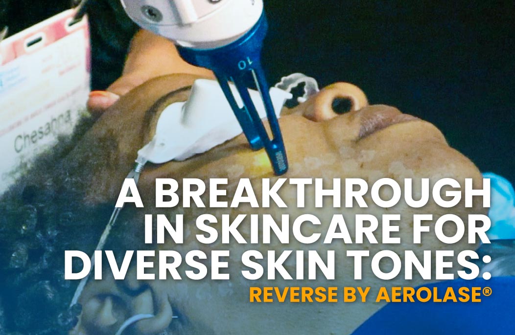 Reverse by Aerolase Breakthrough in Skincare for Diverse Skin Tones