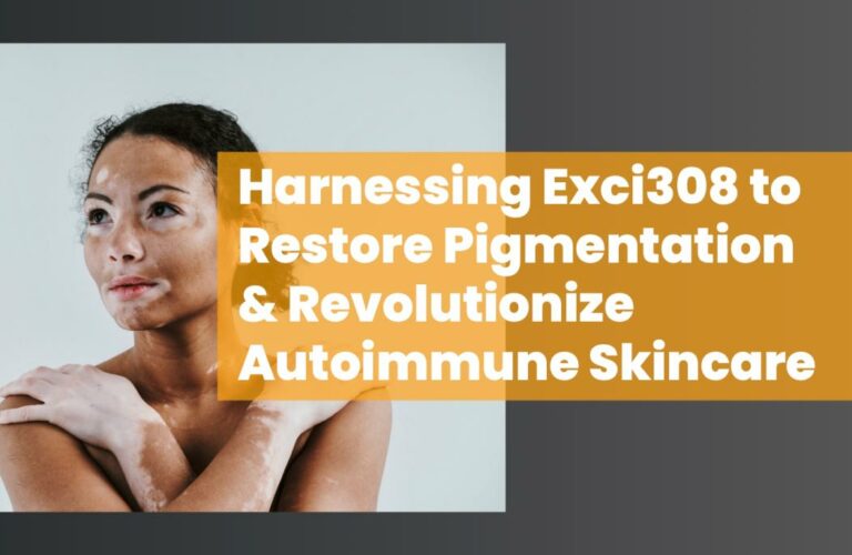 Exci308 by Aerolase Restore Pigmentation Autoimmune Skin Care