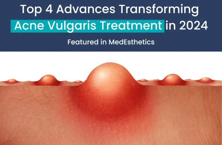 Top 4 Advances Transforming Acne Vulgaris Treatment in 2024